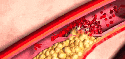 1576031897526662.gif 0.gif
